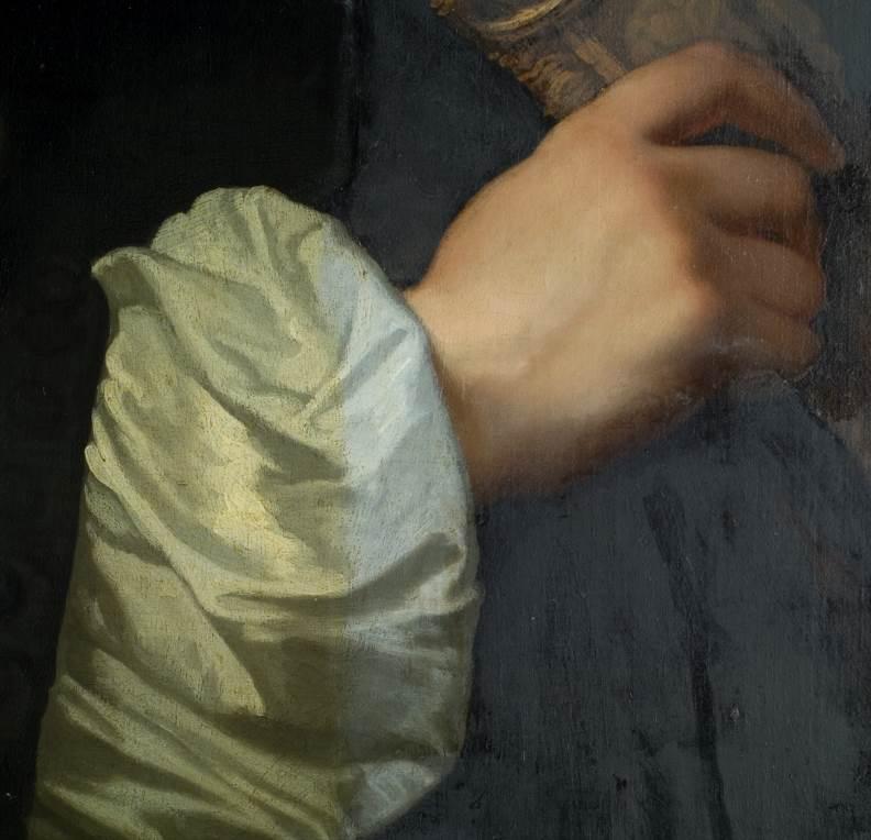 Detail of Teddeman’s arm during cleaning